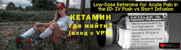 мдпв Инта